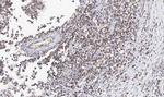 ADC Polyclonal Antibody