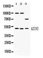 ADC Antibody in Western Blot (WB)