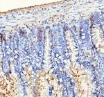 BAG1 Antibody in Immunohistochemistry (Paraffin) (IHC (P))