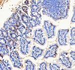 BAG1 Antibody in Immunohistochemistry (Paraffin) (IHC (P))