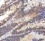BAG1 Polyclonal Antibody