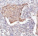 BAG1 Antibody in Immunohistochemistry (Paraffin) (IHC (P))