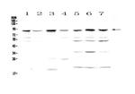 BAP1 Polyclonal Antibody