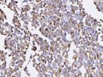 BCAT1 Polyclonal Antibody