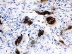 Osteocalcin Polyclonal Antibody