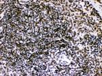 BIK Antibody in Immunohistochemistry (Paraffin) (IHC (P))