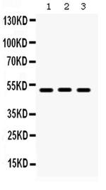 BMP5 Antibody in Western Blot (WB)