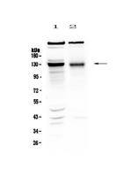 BMPR2 Polyclonal Antibody
