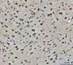 BRCA1 Antibody in Immunohistochemistry (Paraffin) (IHC (P))