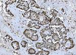 BRCA1 Antibody in Immunohistochemistry (Paraffin) (IHC (P))