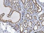 BRCA1 Antibody in Immunohistochemistry (Paraffin) (IHC (P))