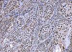 BRCA1 Polyclonal Antibody