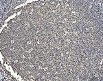 BRCA1 Antibody in Immunohistochemistry (Paraffin) (IHC (P))