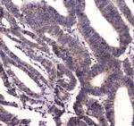 BRD7 Antibody in Immunohistochemistry (Paraffin) (IHC (P))