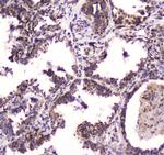 BRD7 Antibody in Immunohistochemistry (Paraffin) (IHC (P))