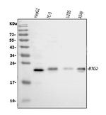BTG2 Polyclonal Antibody