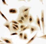 Bub3 Polyclonal Antibody