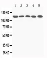 Complement C5a Antibody in Western Blot (WB)
