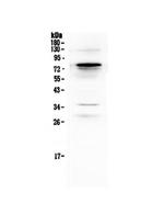 Complement C9 Antibody in Western Blot (WB)