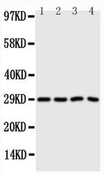 Carbonic Anhydrase III Antibody in Western Blot (WB)