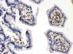 Caldesmon Antibody in Immunohistochemistry (Paraffin) (IHC (P))