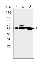 CaMKK alpha Antibody in Western Blot (WB)