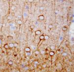 CaMKK alpha Polyclonal Antibody