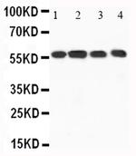 CaMKK alpha Antibody in Western Blot (WB)