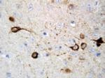 CAMKK2 Antibody in Immunohistochemistry (Paraffin) (IHC (P))