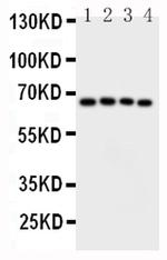 CAMKK2 Antibody in Western Blot (WB)