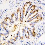 Calpain 1 Antibody in Immunohistochemistry (Paraffin) (IHC (P))