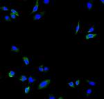 Calpain 2 Polyclonal Antibody