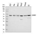 PRMT4 Antibody in Western Blot (WB)