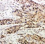 Caspase 14 Polyclonal Antibody