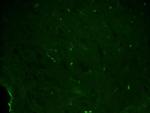 Caspase 3 p10 Antibody in Immunohistochemistry (Paraffin) (IHC (P))