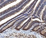 Caspase 6 p18 Polyclonal Antibody