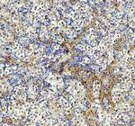 AAMP Polyclonal Antibody