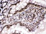 Cyclin T1 Antibody in Immunohistochemistry (Paraffin) (IHC (P))
