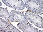 CP110 Antibody in Immunohistochemistry (Paraffin) (IHC (P))