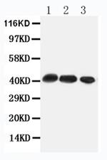 CCR4 Polyclonal Antibody