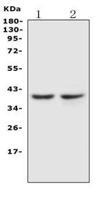 CCR5 Polyclonal Antibody