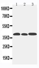 CCR5 Polyclonal Antibody