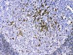 CCS Polyclonal Antibody