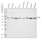 TCP-1 beta Antibody in Western Blot (WB)