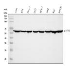 TCP-1 beta Antibody in Western Blot (WB)