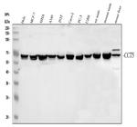 TCP1 epsilon Antibody in Western Blot (WB)