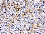 TCP1 epsilon Antibody in Immunohistochemistry (Paraffin) (IHC (P))
