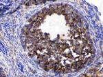 TCP1 epsilon Antibody in Immunohistochemistry (Paraffin) (IHC (P))