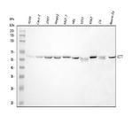 TCP1 eta Antibody in Western Blot (WB)