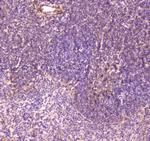 CD163 Antibody in Immunohistochemistry (Paraffin) (IHC (P))
